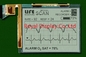 320*240 FSTN-LCD-Modul Monochrom für medizinischen Scan positiv