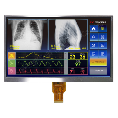 10.1'' 1024*RGB*600 TFT-LCD-Modul 16:9 Breitblick MIPI-Schnittstelle Winstar-Ersatz